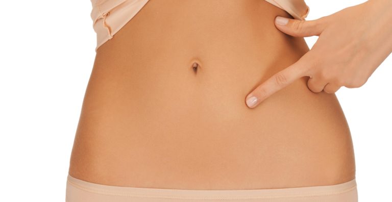 mini tummy tuck